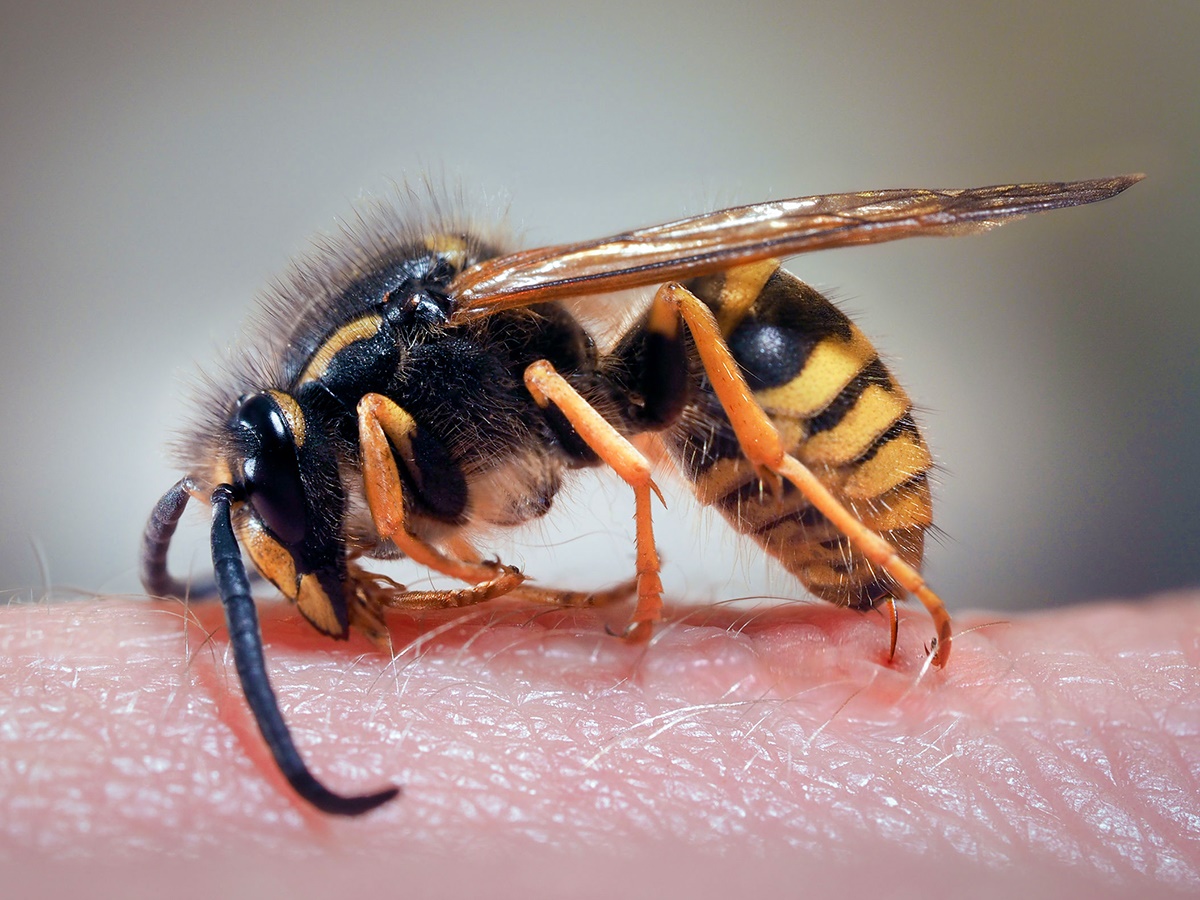 The sting of a wasp on a human hand. Note the swelling and redness.